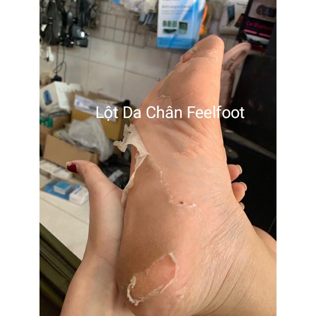 [HCM]Feelfoot Lột Trắng Da Chân Hết Chai Sần