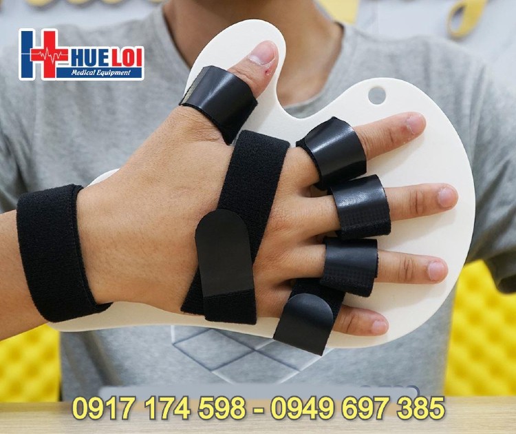 Nẹp cố định bàn tay