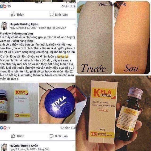 KELA LOTION Thái Lan - XÓA VIM LỖ CHÂN LÔNG