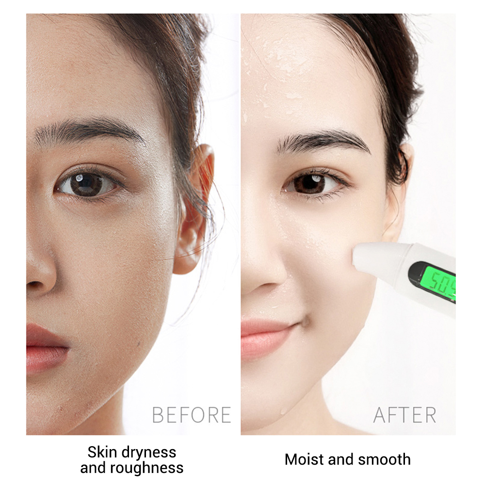 LANBENA Bộ 5 mặt nạ chứa axit hyaluronic