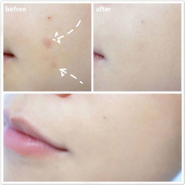 Kem nền che khuyết điểm AGC FLAWLESS 30ml