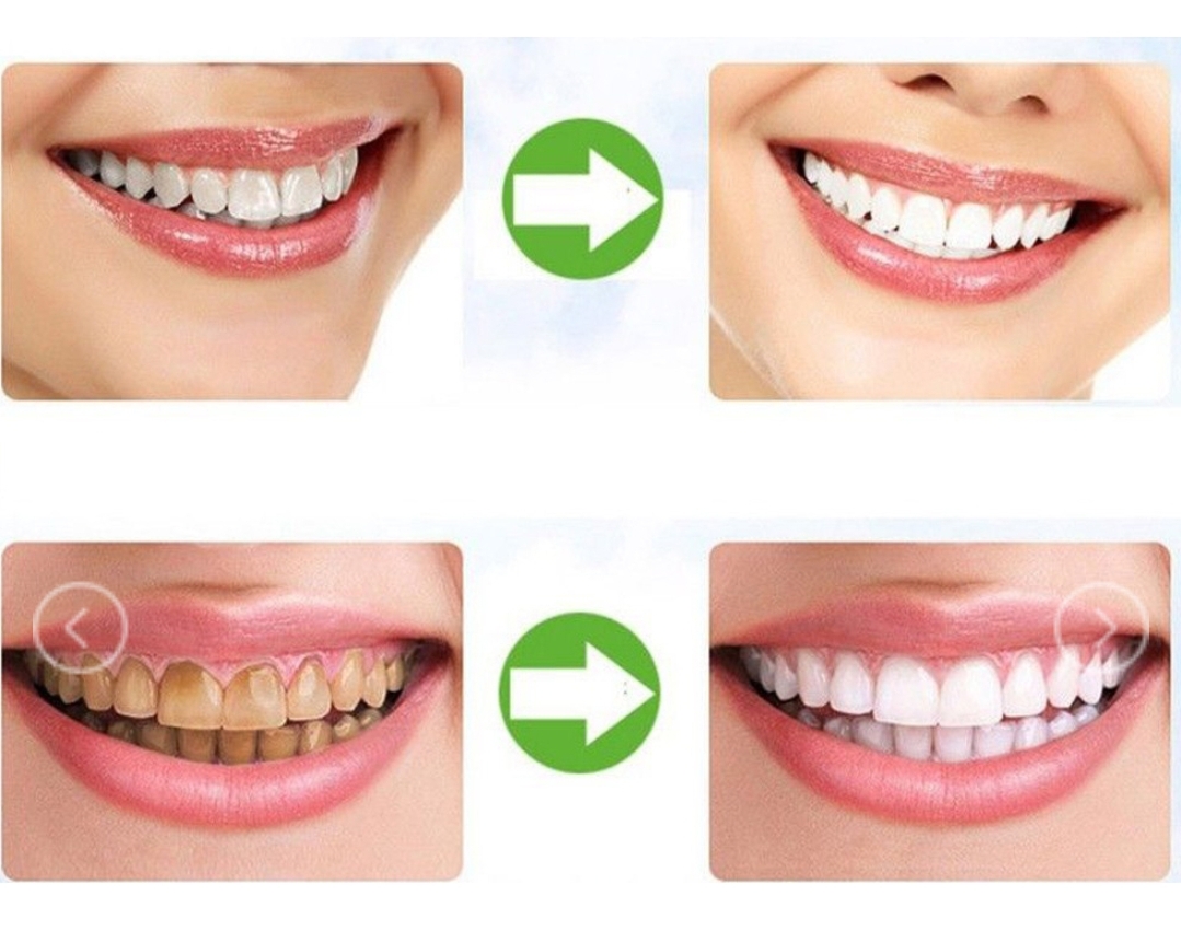 BỘT TRẮNG RĂNG THAN HOẠT TÍNH