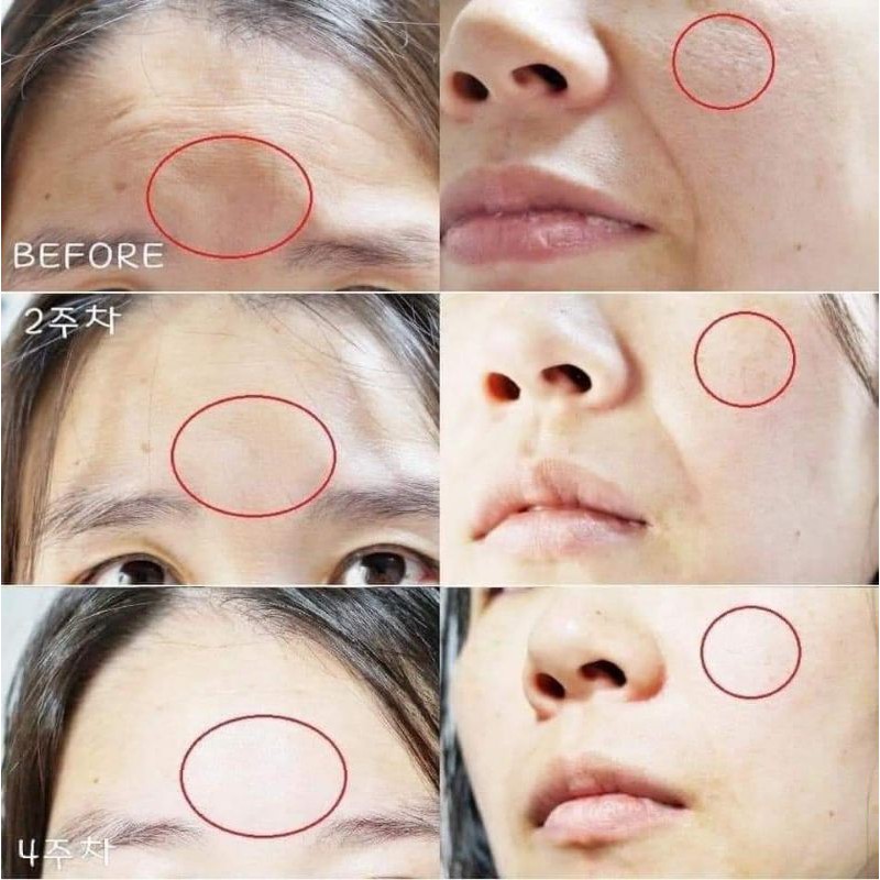 Tinh chất ILDONG PROBIOTIC SERUM