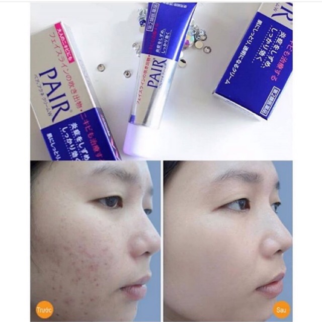 Kem mụn PAIR  24g Nhật Bản