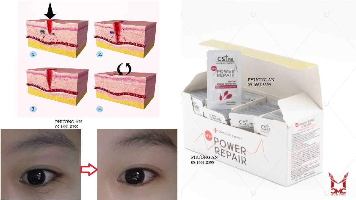 CS Lab Hàn Quốc dưỡng da sau xăm - 1 gói