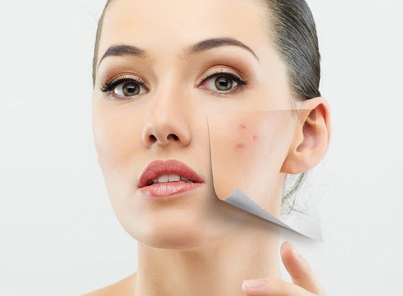 Serum mụn Thorakao 7g
