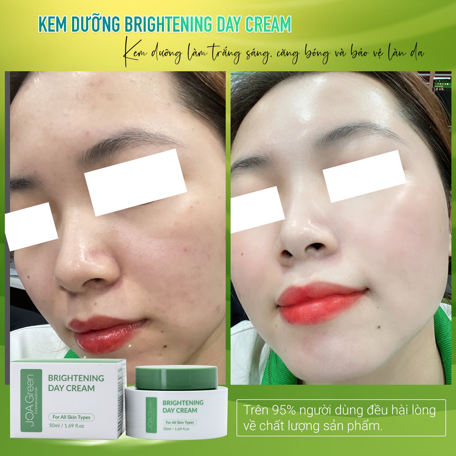 [COMBO THĂNG HẠNG NHAN SẮC] Giúp Phục Hồi, Dưỡng Trắng Da (Tặng 1 Tẩy Tế Bào Chết MS 100ml) - Mỹ Phẩm MS COSMETIC