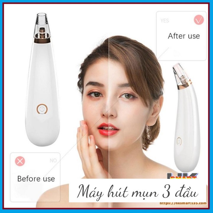 Dụng cụ chăm sóc da mặt tại nhà trị mụn trứng cá hiệu quả - Máy hút mụn 3 đầu thay phù hợp với từng vùng da mặt, chống thấm nước, sử dụng pin AA thông dụng, lực hút vừa phải an toàn cho da