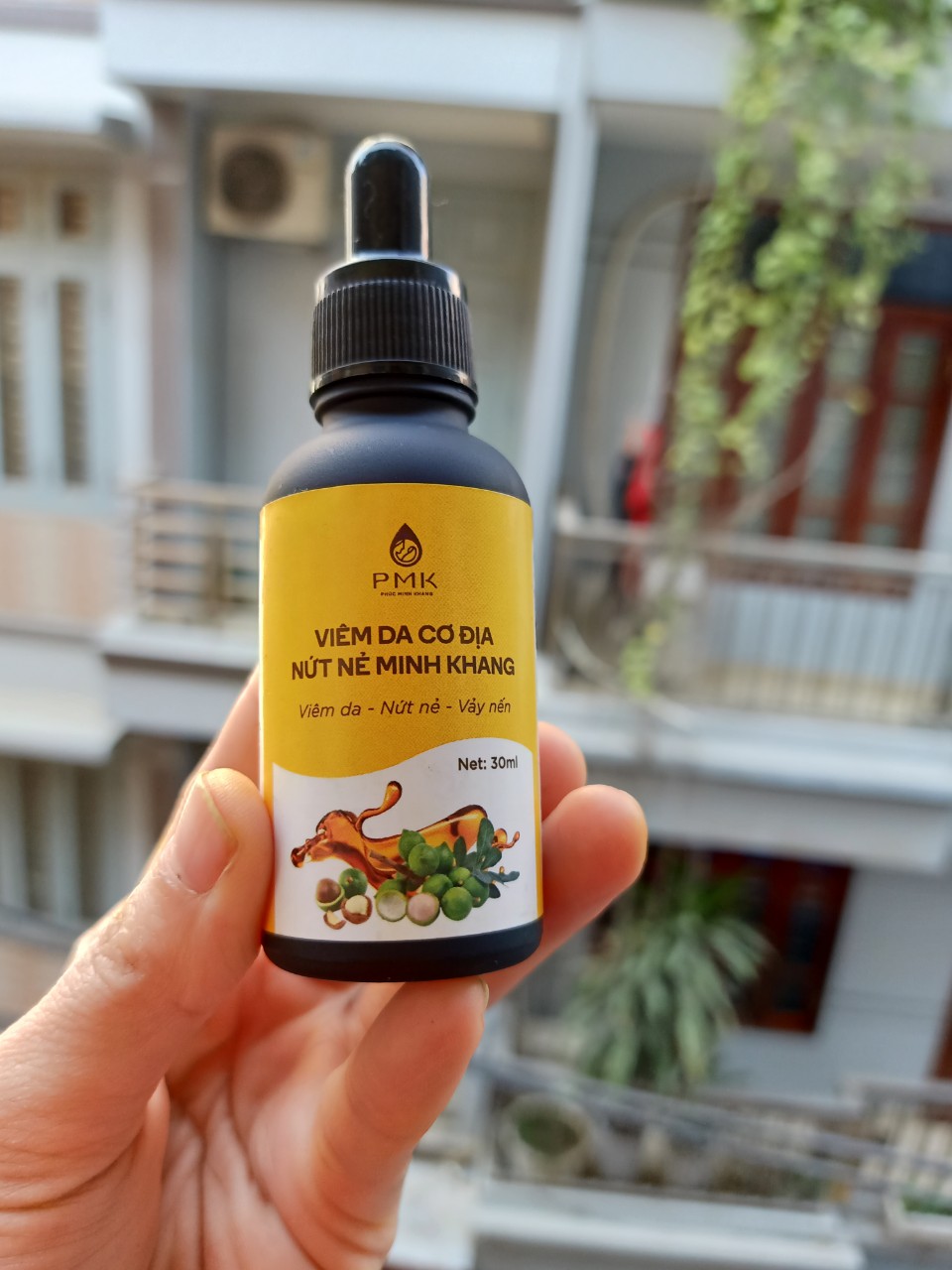 Viêm da nứt nẻ vẩy nến Phúc Minh Khang
