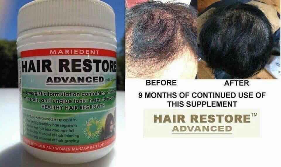 mọc tóc Mariedent Hair Restore Advanced 60 viên của Úc