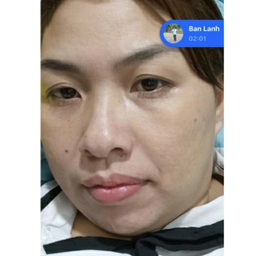 SERUM THẢO DƯỢC NHÂN SÂM SẠCH MỤN MAY NEW 50ML