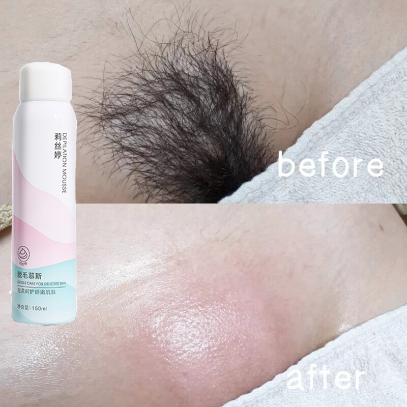 xịt tẩy lông Tẩy lông vùng kín dành cho da nhạy cảm, an toàn,