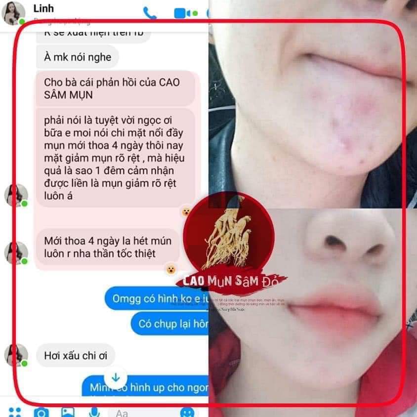 Combo Cao Mụn Sâm Đỏ + Sữa rửa mặt Nhân Sâm - sạch mụn sáng da