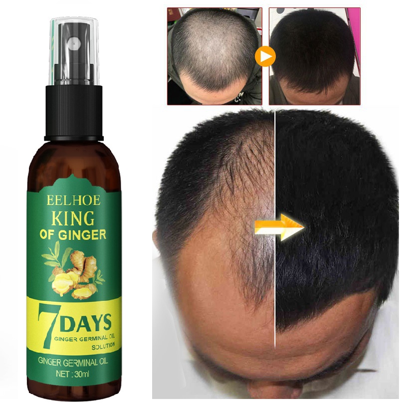 Xịt mọc tóc eelhoe tinh chất gừng tươi kích thích mọc tóc, giảm gãy rụng, giúp tóc chắc khỏe sau 7 ngày 30ml
