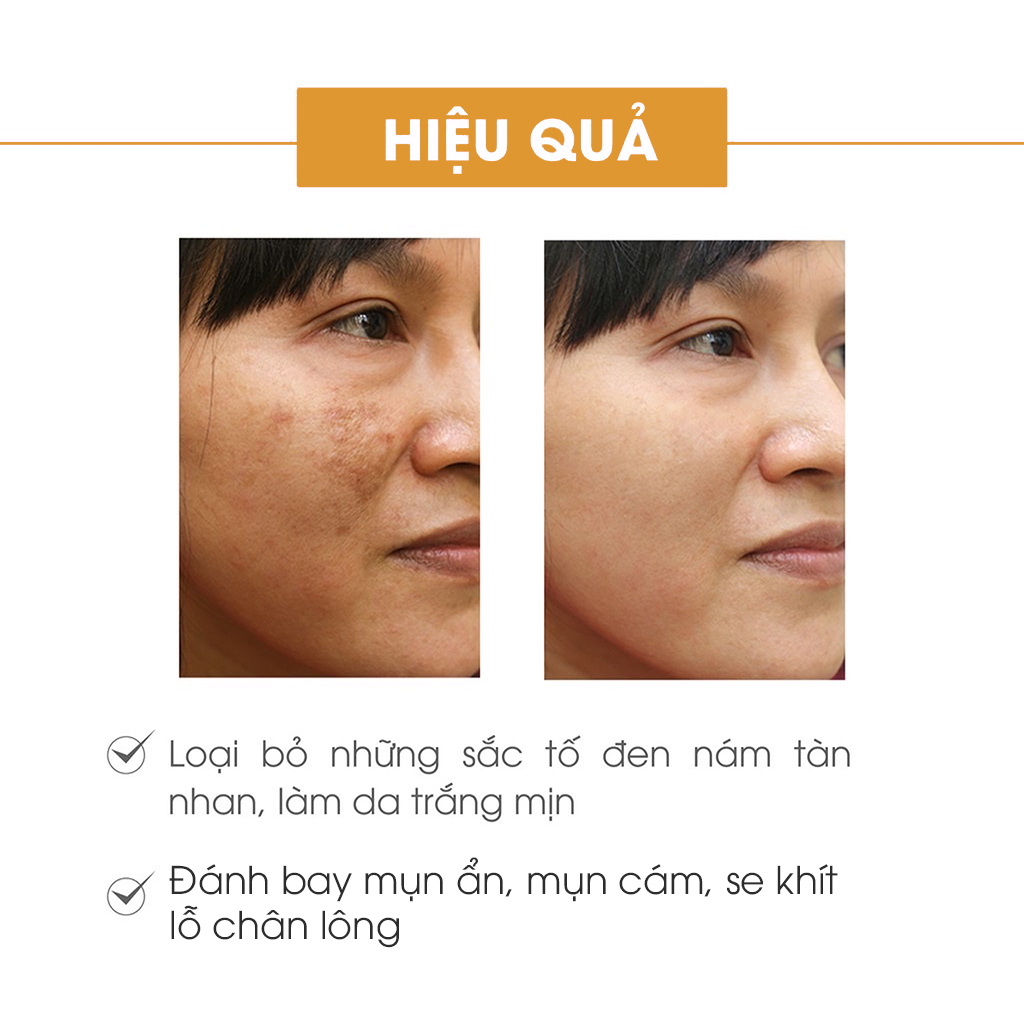 Kem Face Pháp mẫu mới Acosmetic 50g