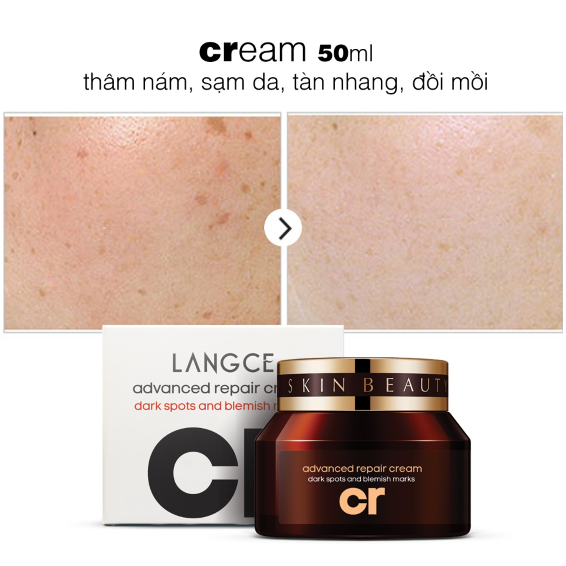 CReam THÂM NÁM, SẠM DA, TÀN NHANG, ĐỒI MỒI 50ml LANGCE