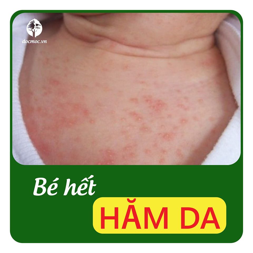 Muối Tắm Bé Sinh Dược 400gr