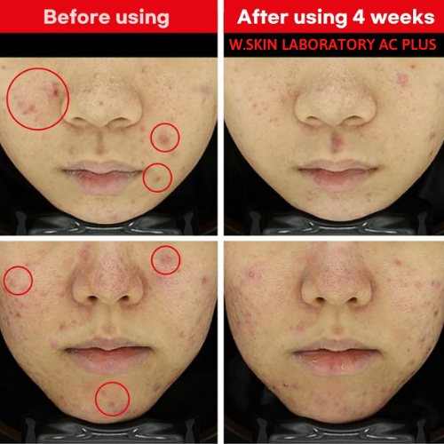 [QUÀ TẶNG] 5 Sample dưỡng da W.SKIN LABORATORY