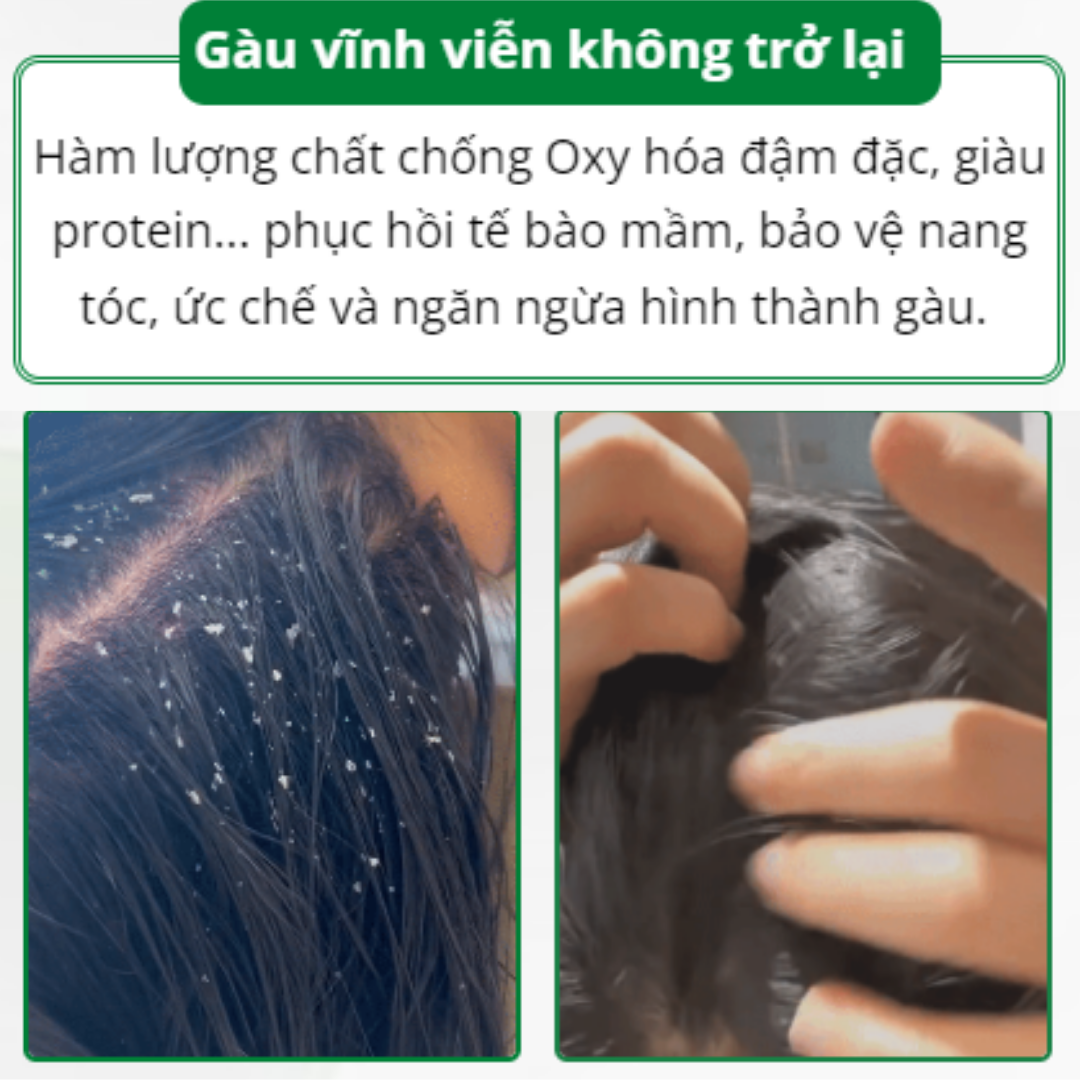 Dầu gội nhuộm tóc nâu hạt dẻ Helloii Buble- Dầu gội nhuộm tóc màu nâu hạt dẻ, nhuộm nhanh chóng, ngăn rụng tóc, an toàn, giúp tóc chắc khoẻ