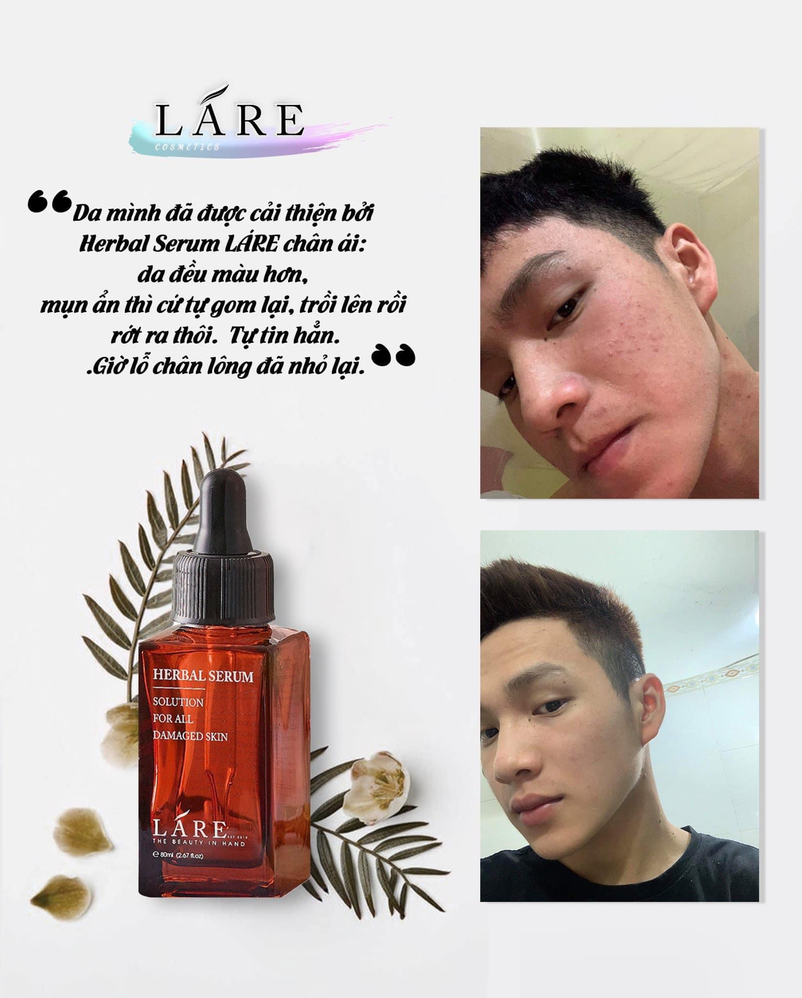 Combo Thanh Dược Lare( serum 50ml+mask trắng da 120gr+srm12gr)