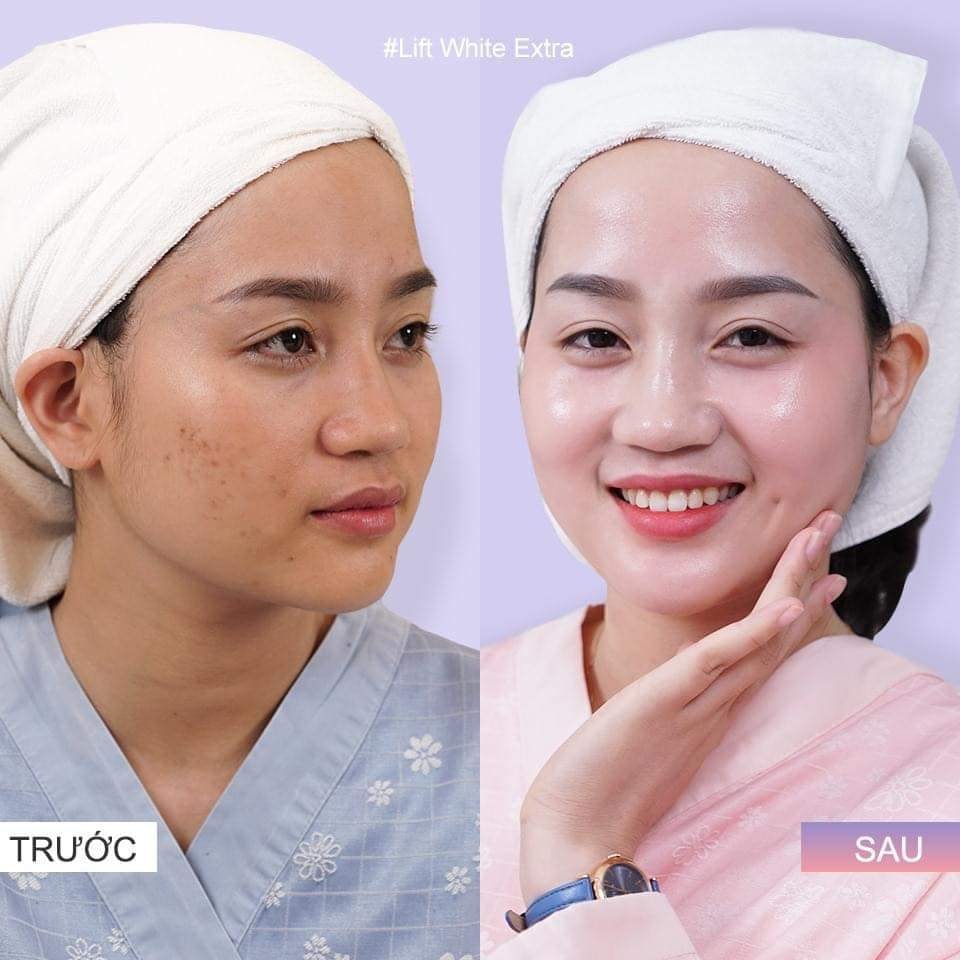 ( CHÍNH HÃNG ) KEM HÚT NÁM - MỜ TÀN NHANG - GIẢM THÂM OLLCELL 30GR - HÀNG CÓ SẴN CUNG CẤP CHO SPA , KHÁCH LÀM LIỆU TRÌNH