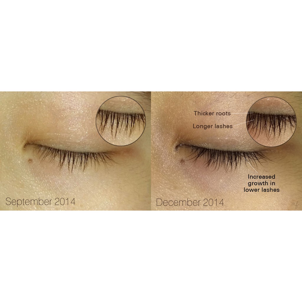 [HCM]Tinh chất dưỡng mi Dhc Eyelash Tonic 6.5ml