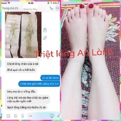 Combo triệt lông từ wax lông và mỡ trăn An Lành (tặng kèm giấy)