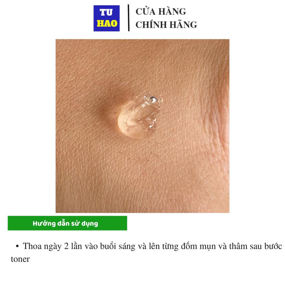 Gel TRỊ Mụn Trứng Cá Megaduo 15g