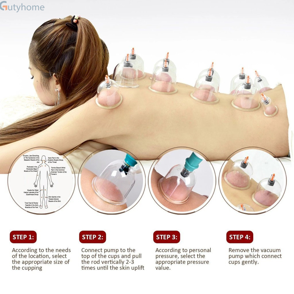 Bộ Giác Hơi 12 Ống Hút Chân Không, Không Cần Dùng Lửa, Giảm Đau Vai, Cổ Lưng, Gáy, Giải Cảm, Thích Hợp Người Lớn Tuổi, Người Làm Việc Nặng.
