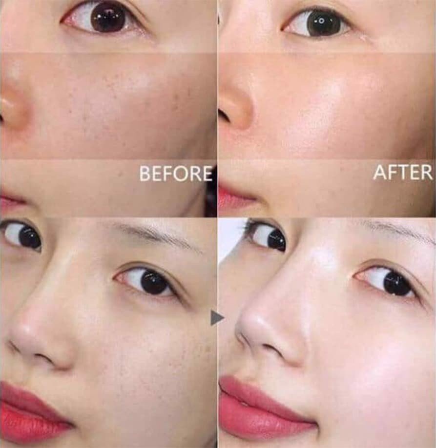 Tinh Chất Serum Dongsung Rannce 45ml