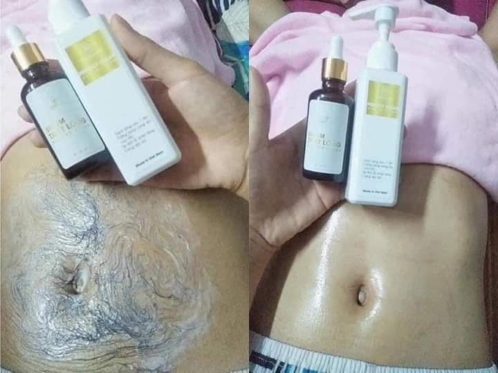 (Combo 1 kem tẩy lông tặng 1 serum triệt lông)Kem tẩy Lông Huyền Phi