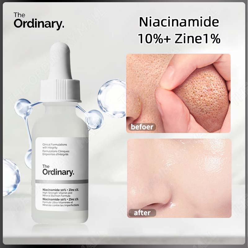 Serum the ordinary Niacinamide 10% + Zinc 1% Serum dưỡng da phục hồi da chính hãng