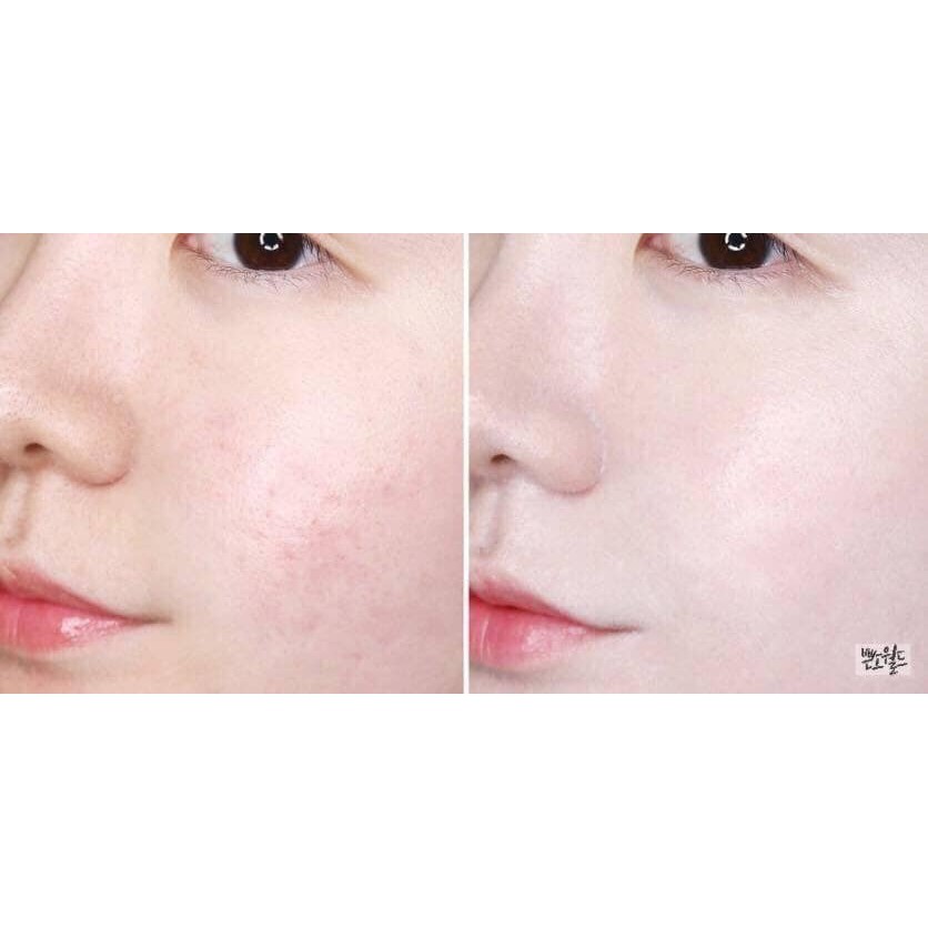 KEM DƯỠNG DA V7 TONING LIGHT DR.JART mini 15ml giúp da trắng đẹp,lên tông.
