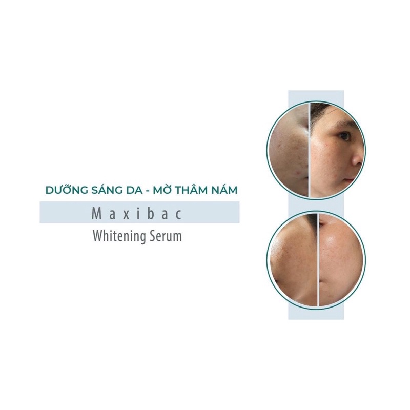 Maxibac Whitening Serum giúp làm sáng da, mờ nám