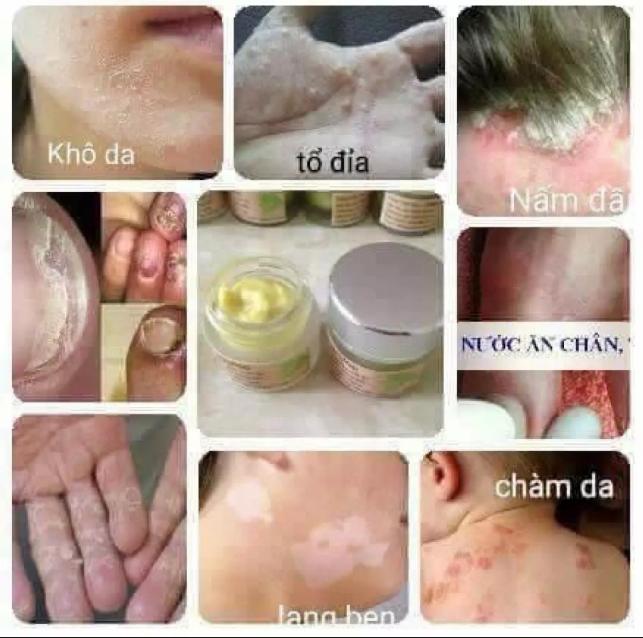 Kem bôi da Hoa Mộc hàng chuẩn