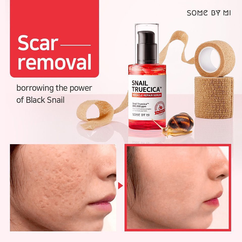 [Lấy mã giảm thêm 30%]Serum Snail Truecica Miracle Repair Some By Mi