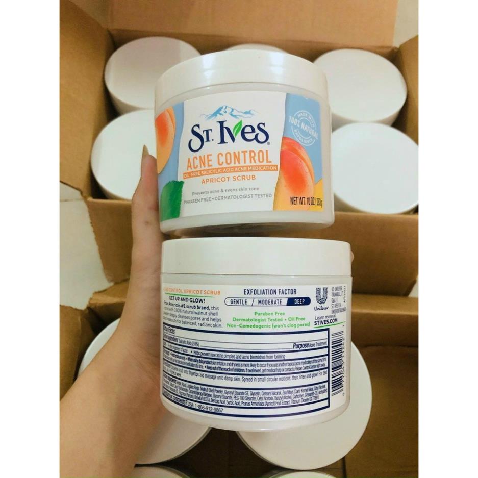 [HÀNG HOT] Tẩy tế bào chết toàn thân ST.ives