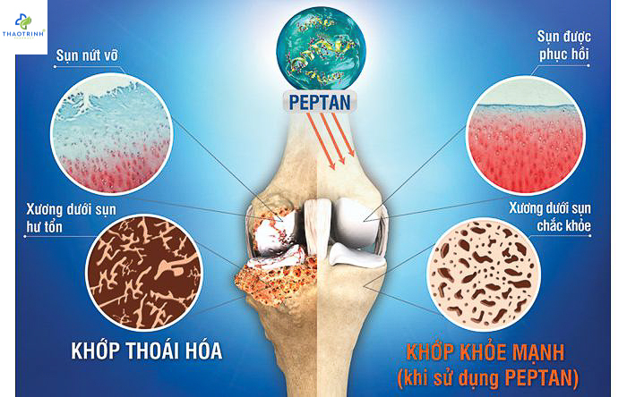 [HCM]Viên nang JEX MAX PEPTAN 15 viên
