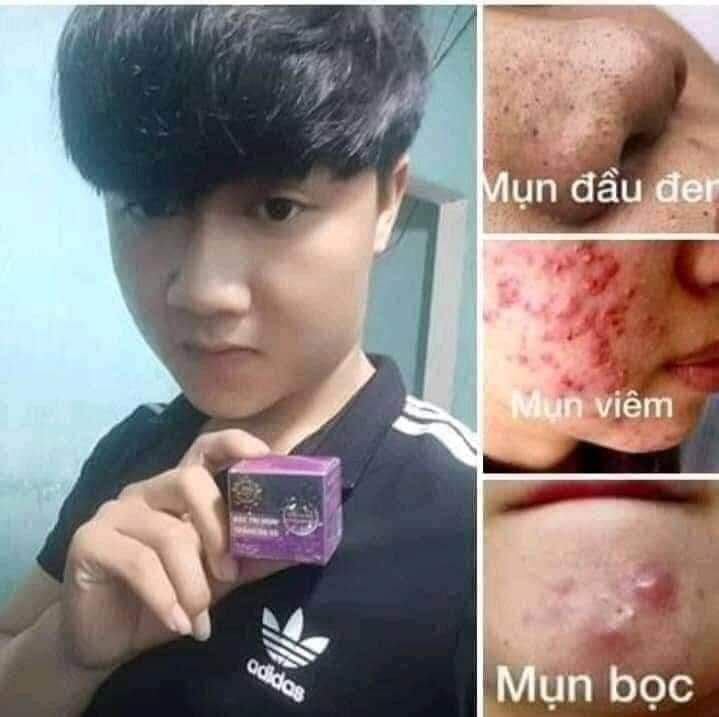 Combo 5 Hộp Kem Mụn 2C
