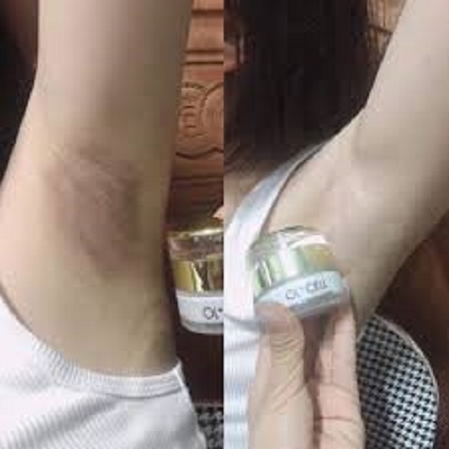 [HCM][ CHÍNH HÃNG ] Kem Trị Thâm Nách Thâm Môi Thâm Đầu Gối OL-CELL