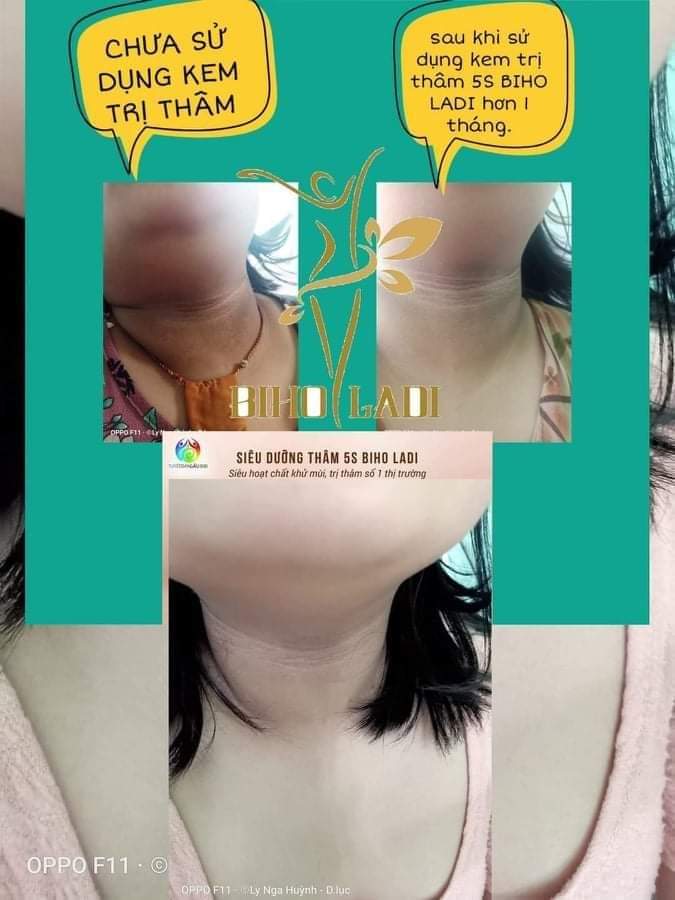 Kem Biho Ladi 5s (Hàng Chính Hãng )