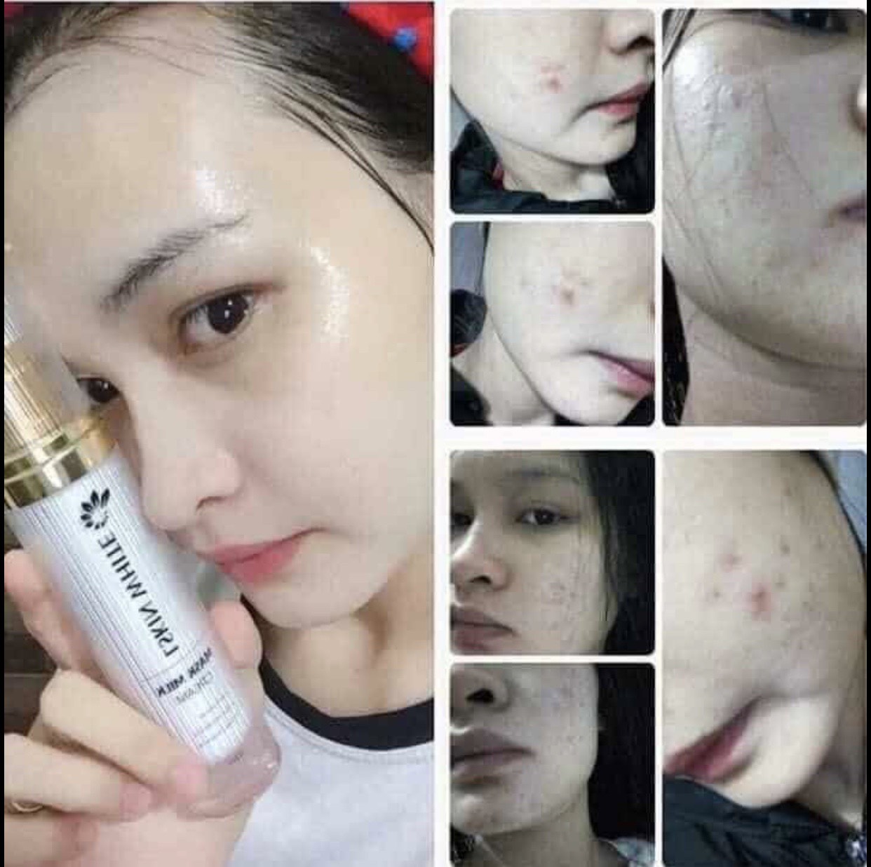 [HCM]Ủ Trắng Kén Tằm LSkin Đan Thy Group