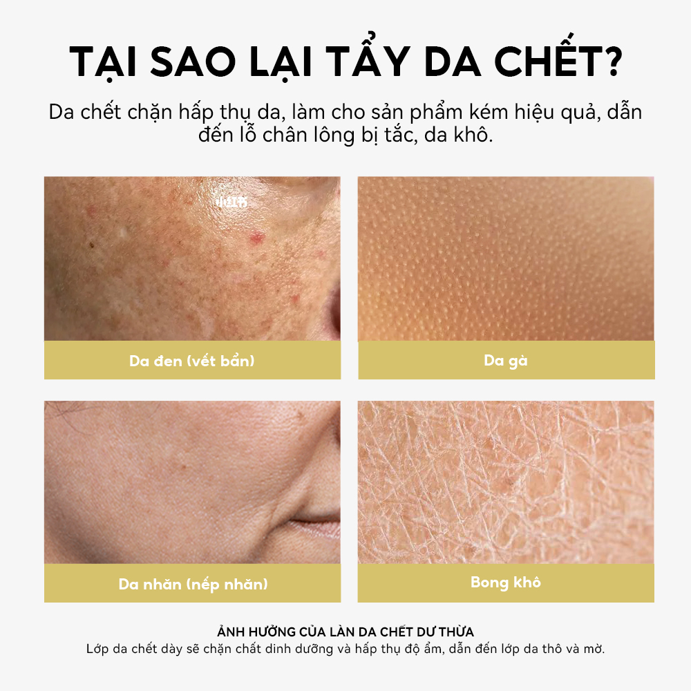 Chai Xịt Tẩy Tế Bào Chết Làm Sạch Da LANBENA 30ml
