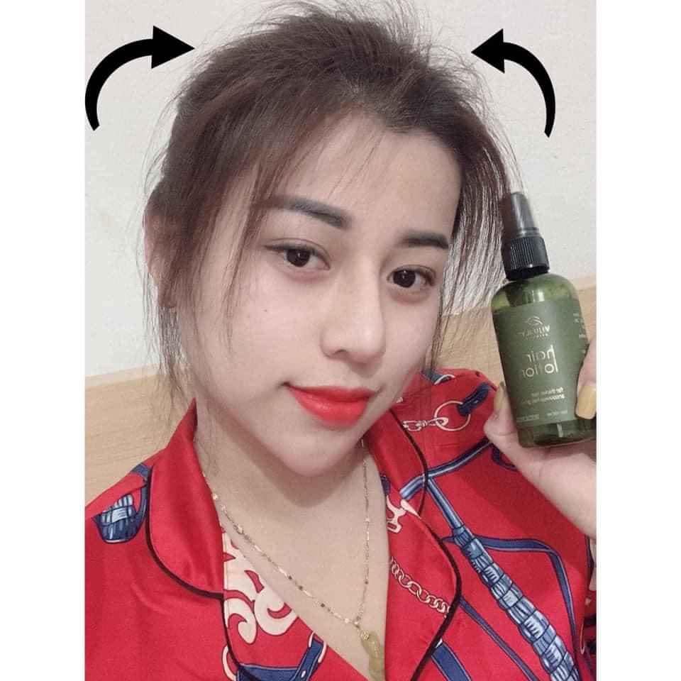 [ Vi Jully ] Combo 5 Chai Tinh Dầu Bưởi Vi Jully Kích Mọc Tóc - Làm Dài Tóc Nhanh