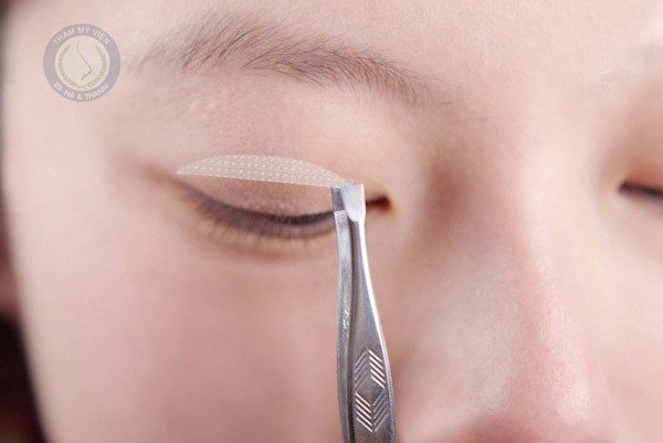 Miếng dán kích mí
