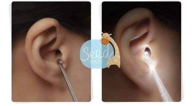 Dụng Cụ Lấy Ráy Tai Có Đèn Led