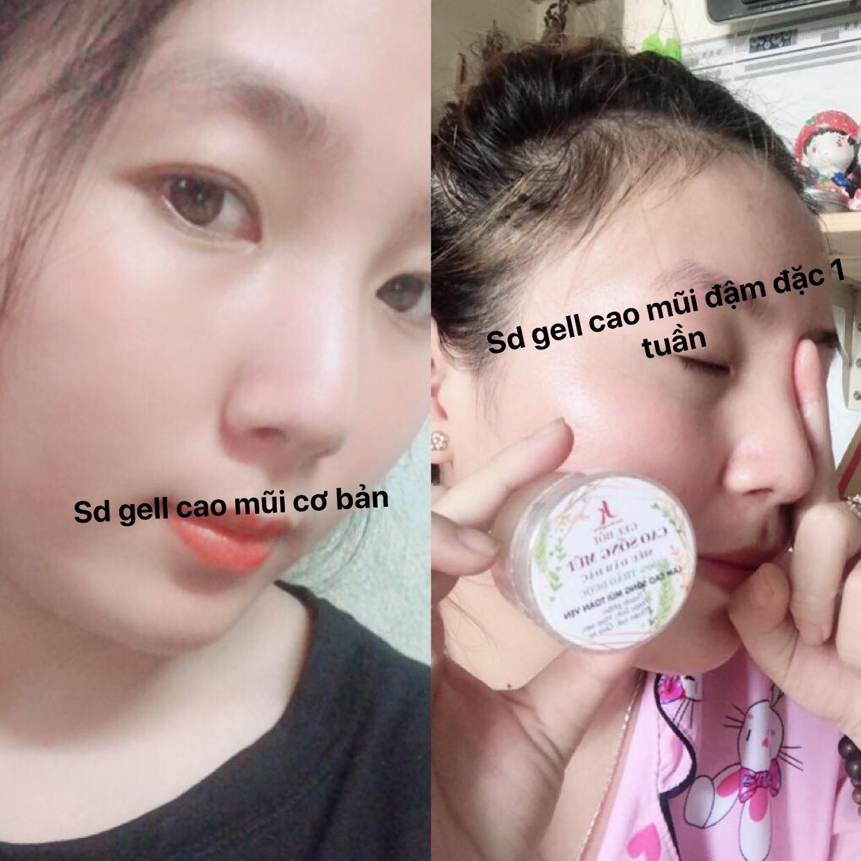 10 gel bôi cao sống mũi 100% thảo dược thiên nhiên - làm cao sống mũi toàn vẹn