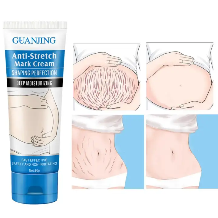 stomach stretch marks cream