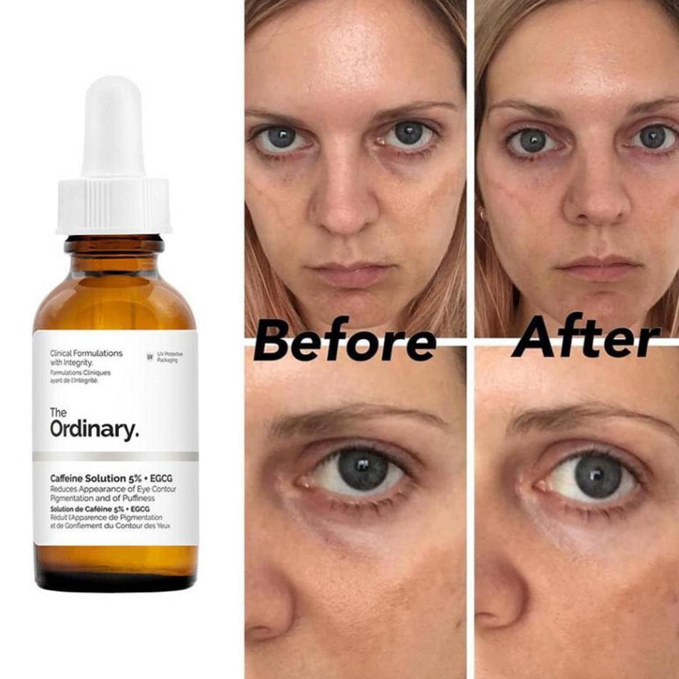 Tinh Chất The Ordinary Caffeine Solution 5% + EGCG ( 30mL )