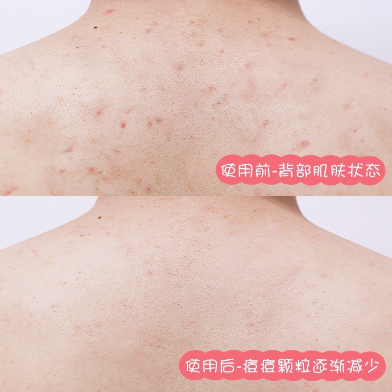 MUỐI TẮM TẨY TẾ BÀO CHẾT TRÁI CÂY